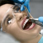 Estrazione dente devitalizzato