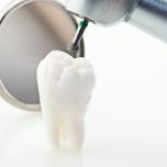 Polpa del dente scoperta