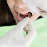 Terapia canalare
