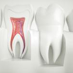 Uccidere nervo dente a casa