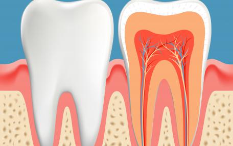 In quanto tempo muore il nervo del dente