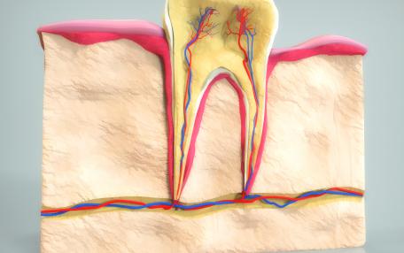 Terapia canalare