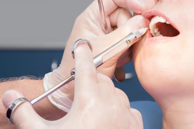Anestesia dentale Anestesia dentale