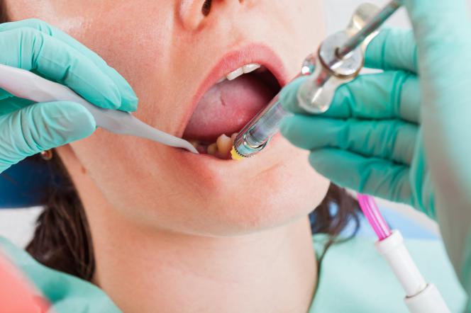 Anestesia locale dentista Anestesia locale dentista