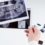 Affollamento dentale