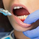 Anestesia dentista effetti collaterali