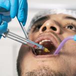 Anestesia dentista fa male