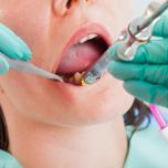 Anestesia dentista non passa