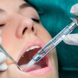 Anestesia dentista