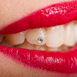 Brillantino al dente costo