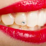 Brillantino al dente