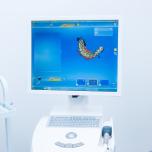 Cad cam dentale