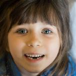 Caduta denti da latte a 5 anni