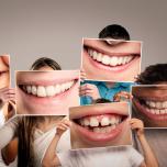 Colore denti