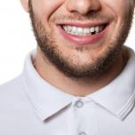 Come rinforzare i denti a cinquant'anni