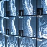 Correlazione tra denti e colonna vertebrale