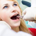 Cosa mangiare dopo estrazione dente