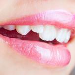 Cuspide dente
