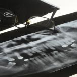 Dentalscan