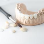 Dente ricostruito