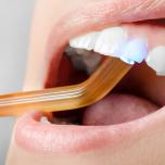 Dente sensibile dopo otturazione