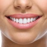Denti che si muovono leggermente
