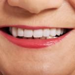 Denti che si spostano a 50 anni
