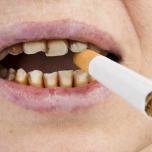 Denti da fumatore