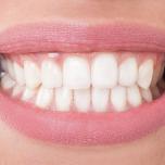 Denti davanti 