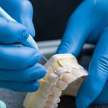 Denti finti perfetti
