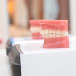 Denti inferiori
