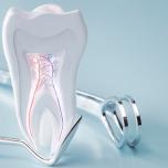Denti molari quali sono