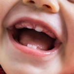 Denti neonato