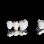 Di che materiale sono fatti i denti finti