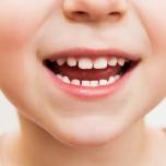Febbre dentini