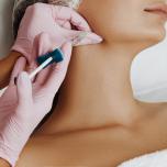 Filler contorno mandibolare