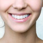Forma dei denti