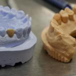 Gesso odontoiatrico