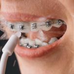 Getto acqua per denti