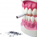Ho fumato dopo estrazione dente