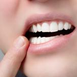 Labbro addormentato dopo anestesia dentista