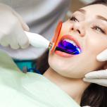 Laser denti