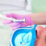 Limare i denti con lima unghie