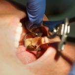 Matrice dentale
