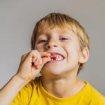Mi dondola un dente permanente