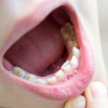 Miracolo ricrescita denti