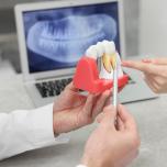 Modellazione dentale