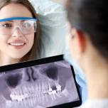 Nervo alveolare inferiore
