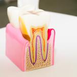 Numero canali denti