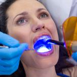 Odontoiatria conservativa ed endodonzia